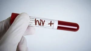 Mitos dan Fakta HIV/AIDS di Lingkungan Masyarakat