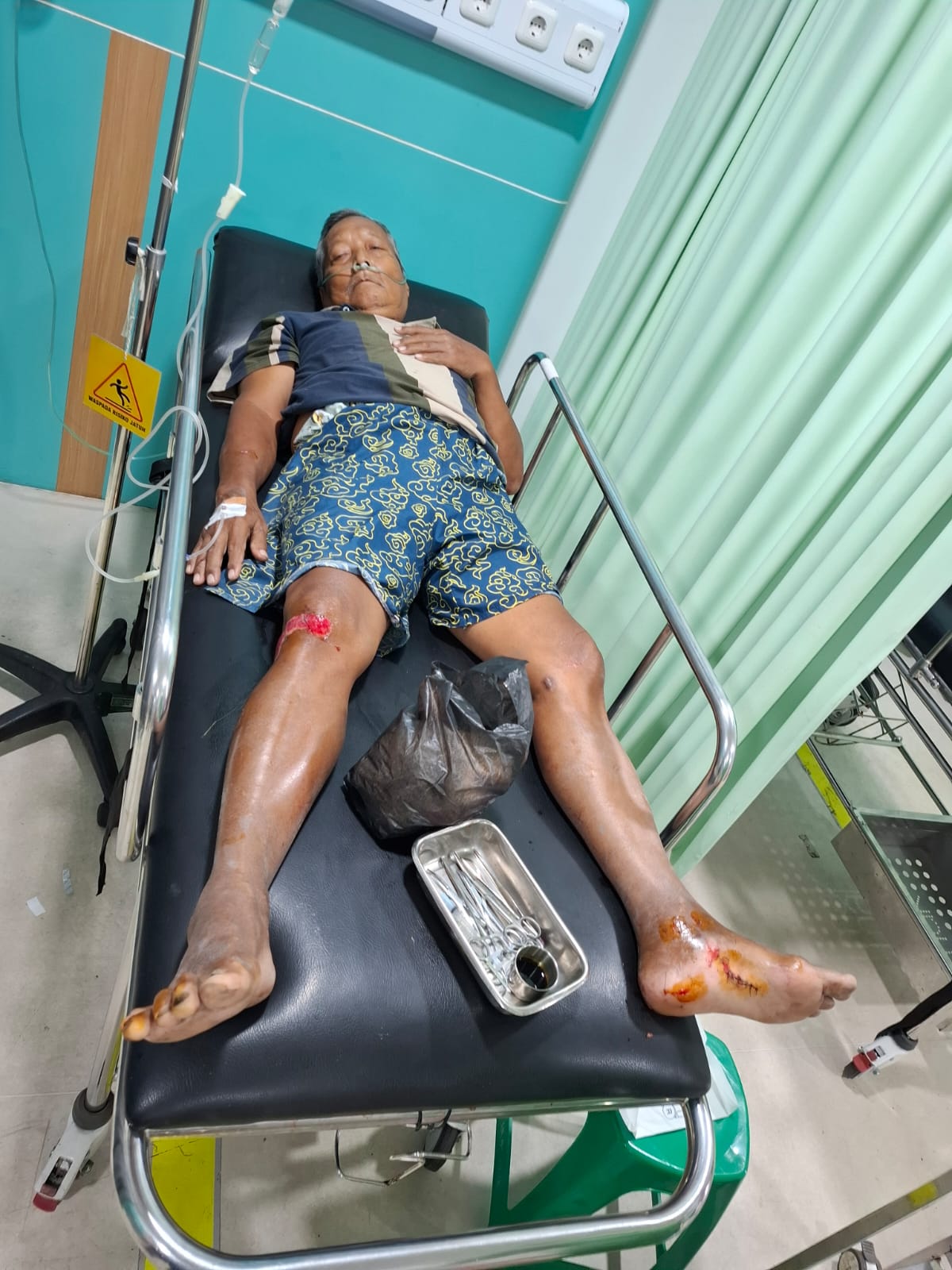 Kecelakaan di Kasihan Bantul, Pemotor Patah Tulang Ditabrak Mobil Ambulans