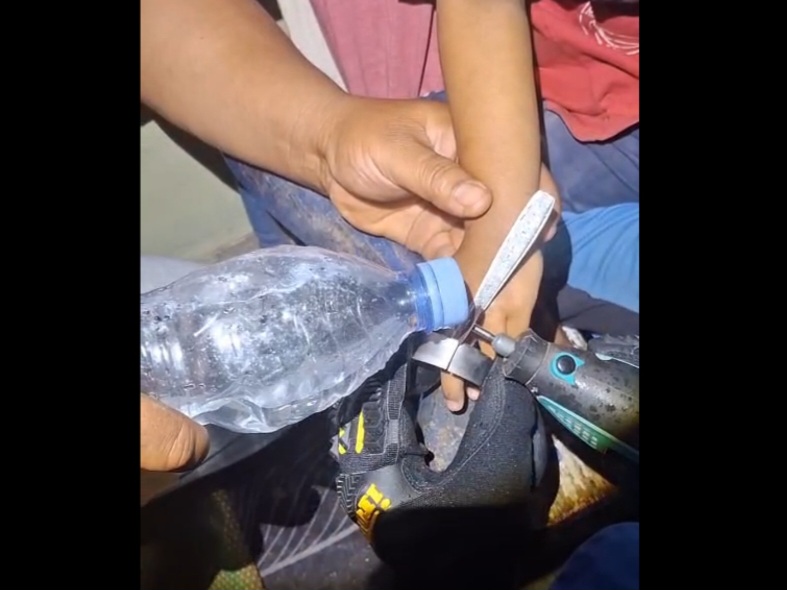 Jari Balita Terjepit Tutup Botol, Damkar Gunungkidul Putar Youtube Kids Saat Evakuasi