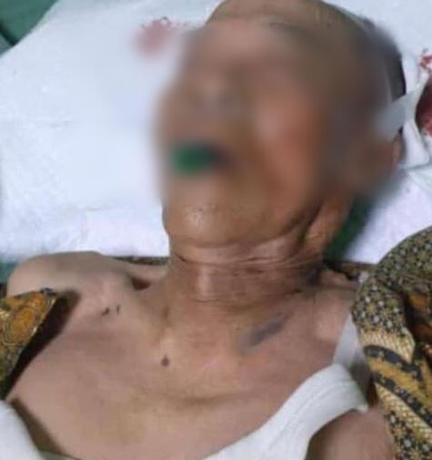 Seorang Kakek Jadi Korban Tabrak Lari di Bogor, Meninggal di RS Belum Dijemput Keluarga 