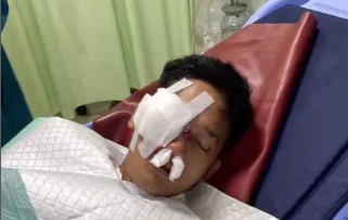 Meresahkan! Geng Motor Magelang Bacok Warga, Mata dan Hidung Korban Luka Parah