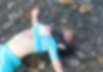 Geger Penemuan Mayat Anak Perempuan di Pantai Lebak Banten, Wajah Diperban Kencang