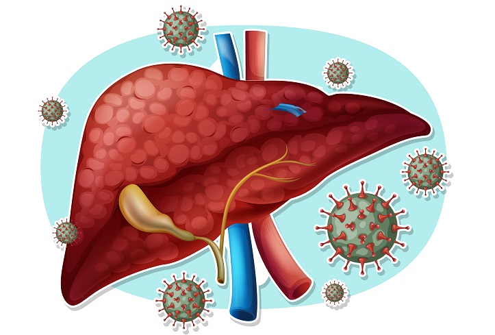 Lebih Dari Setengah Masyarakat Indonesia Belum Memiliki Kekebalan Hepatitis B, Kemenkes: Ini Tugas ...